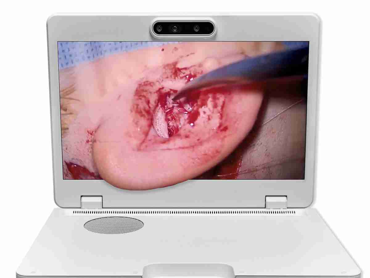 达擎之＂Heads-up 3D显微手术显示系统＂，，，整合4K裸眼3D显示及眼球追踪系统，，，，具备快速追踪人眼移动位置功能，，，减轻医师长时间维持固定姿势的负担，，，，让医师能有更宽广清晰的3D立体视野及更舒适的姿势来执行手术。。。